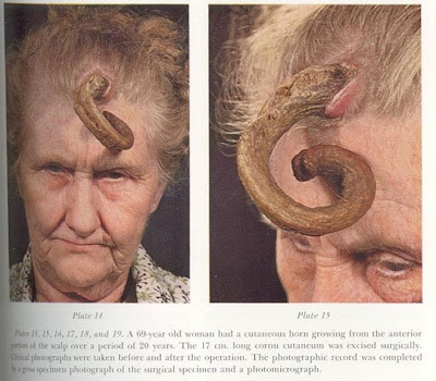 Horn Women