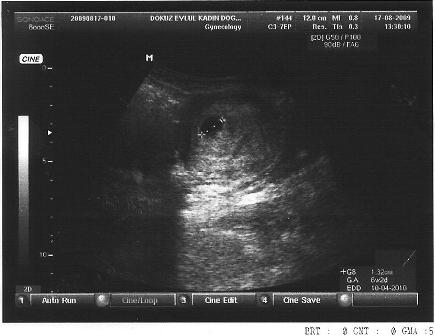 ultrason resimlerimiz