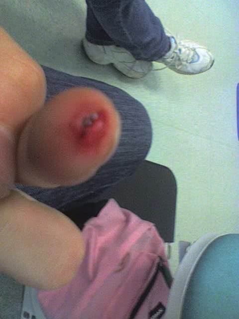 il mio dito che sangina hahah piangete sbarbine!