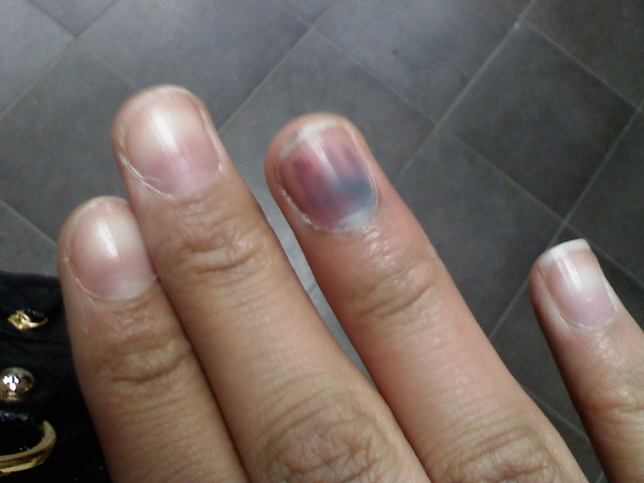 Horrible Nails