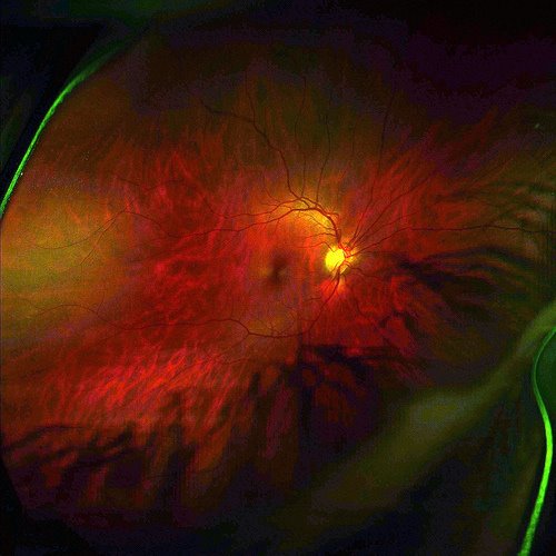 [retinascan.jpg]