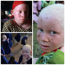Ume albinoak hiltzen dituzte haien itxuragatik edo desberdintasunagatik