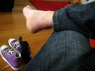 Plantar Fasciitis,Pes Planus,Mallet Toe,High Arched Feet,Heel Spur,Heel Pain,Hammer Toe,Hallux Valgus,Foot Pain,Foot Hard Skin,Foot Conditions,Foot Callous,Flat Feet,Fallen Arches,Diabetic Foot,Contracted Toe,Claw Toe,Bunions Hard Skin,Bunions Callous,Bunion Pain,Ball Of Foot Pain,Back Pain