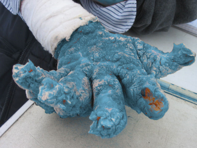 Std Special Fried Rice Disease Diigo Groups Std Special Fried Rice Disease Diigo Groups