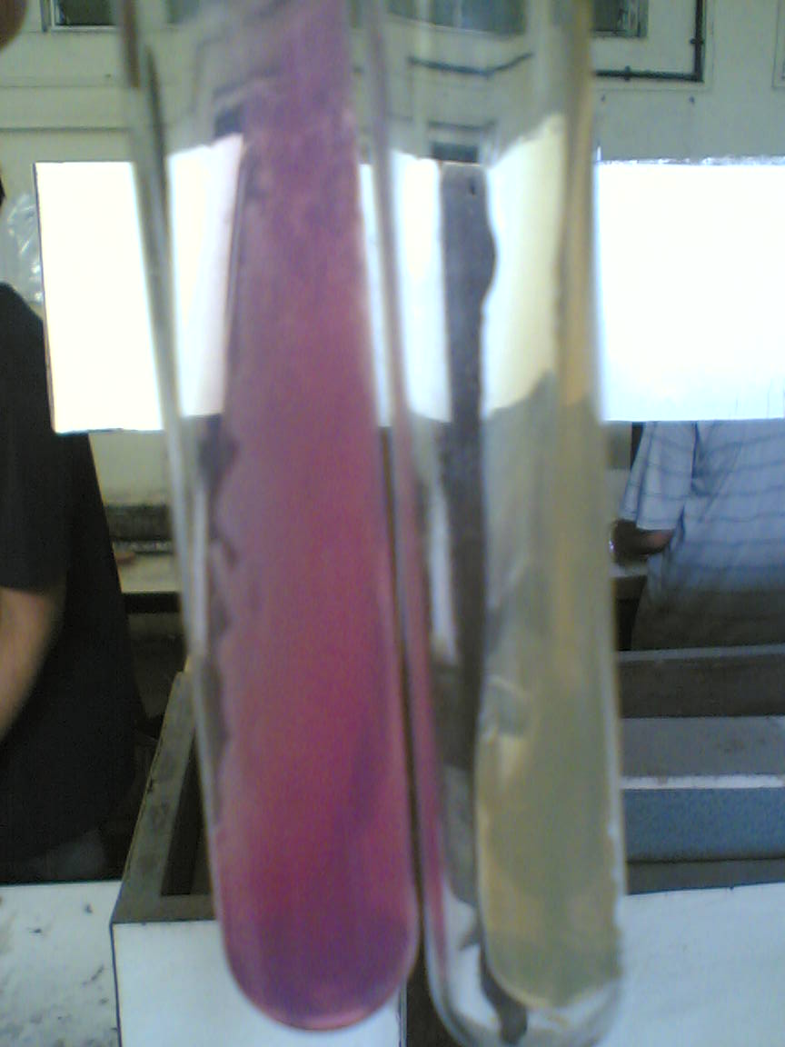 [Urease+pos+neg.jpg]