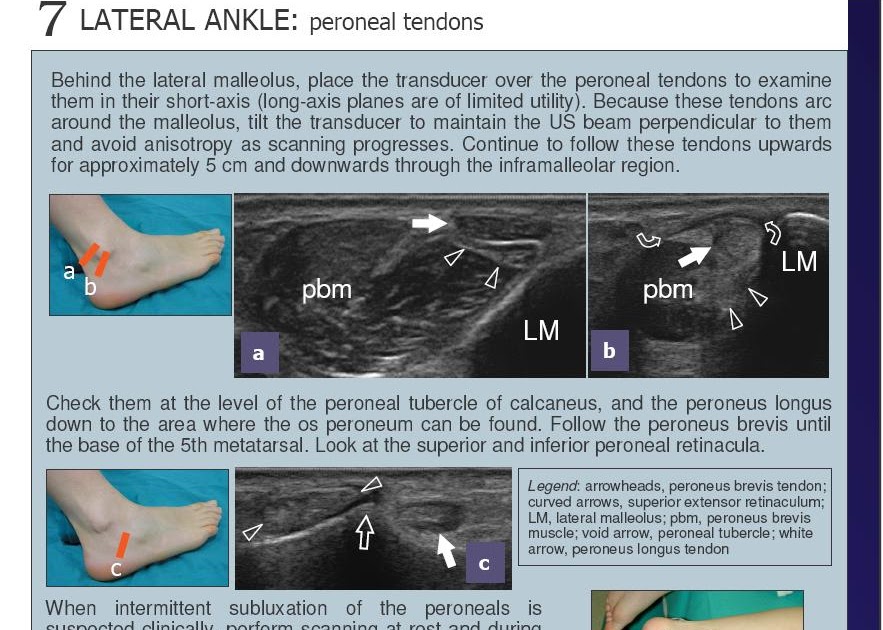 Dr.MazharULKhaliq Ankle Ultrasound