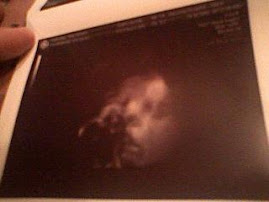 Ultrasound - see me?
