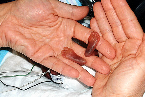 How Support For Abortion