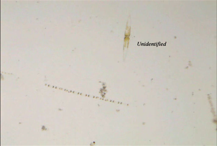 [micro-organism_001.jpg]