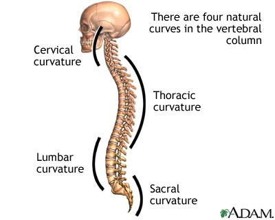 Scoliosis