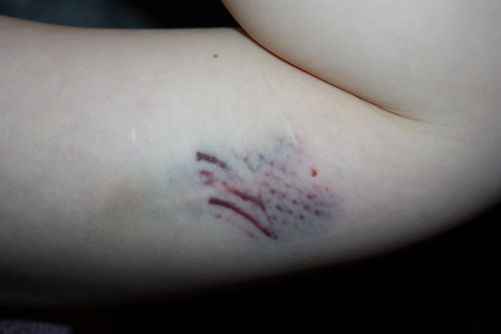 stikking i underlivet ikke gravid jentex stikking i underlivet ikke gravid jentex