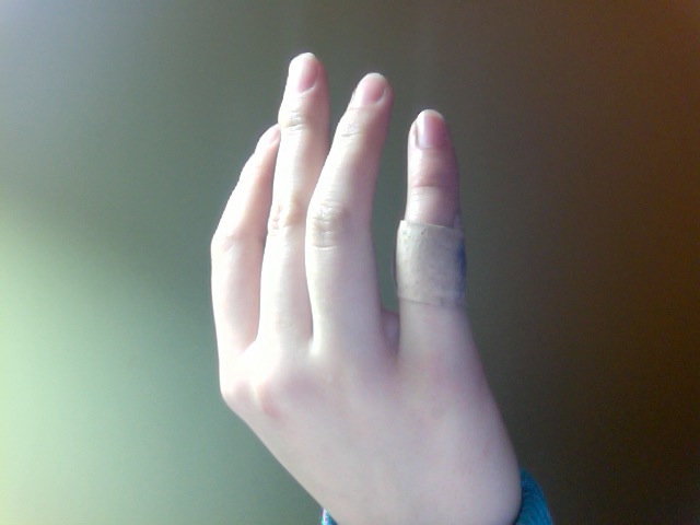 Taking lasix and still swelling