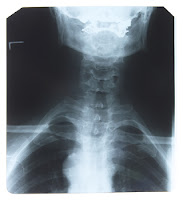X-ray Vital Force Clinic St Louis MO