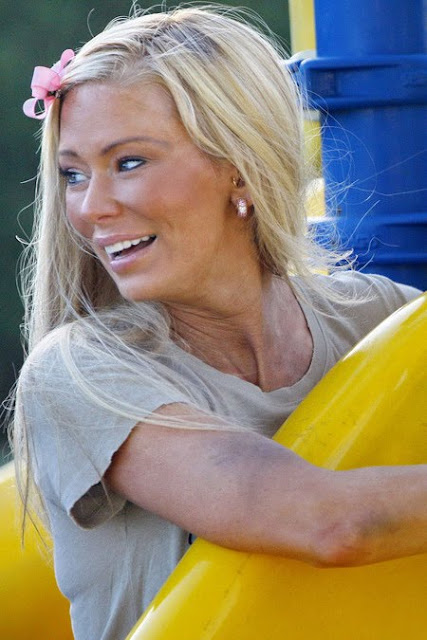 WTF Is Wrong With Jenna Jameson’s FACE???