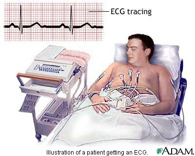 Ecg Record