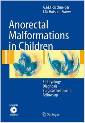 Anorectal Malformations in Children ANORECTAL+MALFORMATIONS