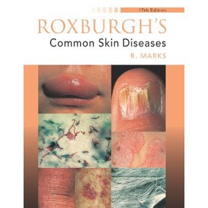 Roxburgh's Common Skin Diseases Roxburgh%27s+Common+Skin+Diseases