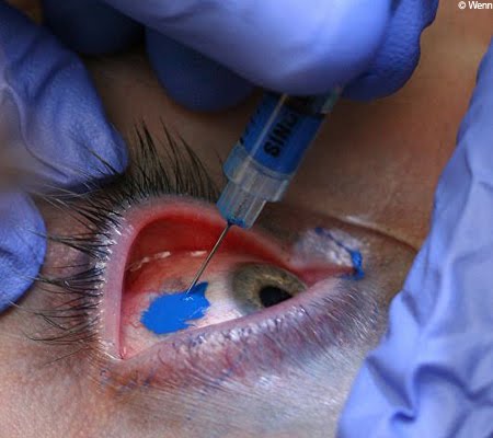 Extreme Eye Tattoo Design tattoo on eye. Extreme Eye Tattoo Design