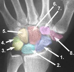 Roentgenbild einer menschlichen Hand