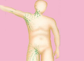 INFLAMACION GANGLIO LINFATICO CUELLO inflamacion ganglio linfatico cuello: