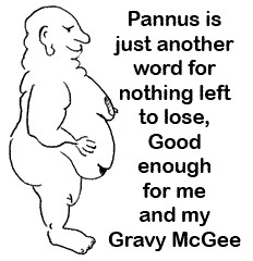 Fat Pannus