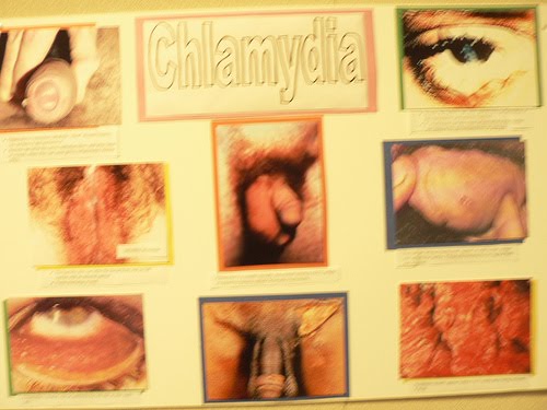 [chlamydia.jpg]