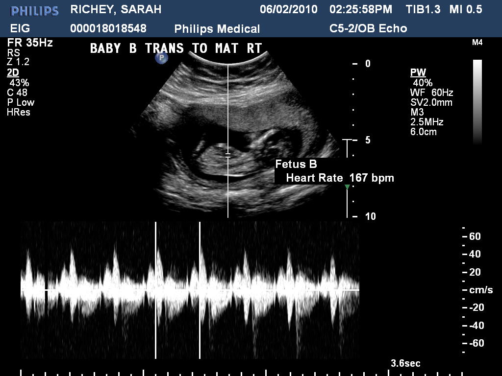 The Life of a Fireman's Wife Ultrasound at Winnie Palmer