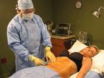 Power Assisted Liposuction