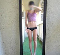 anorexia, cultura anorexia, cultura