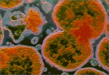 Deadly Germs