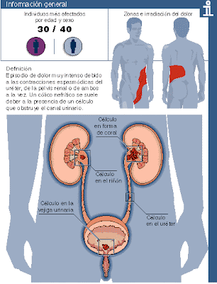 Los ejercicios para el refuerzo de los músculos del departamento de pecho