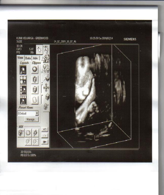 [babyscan3d3+(Large).jpg]