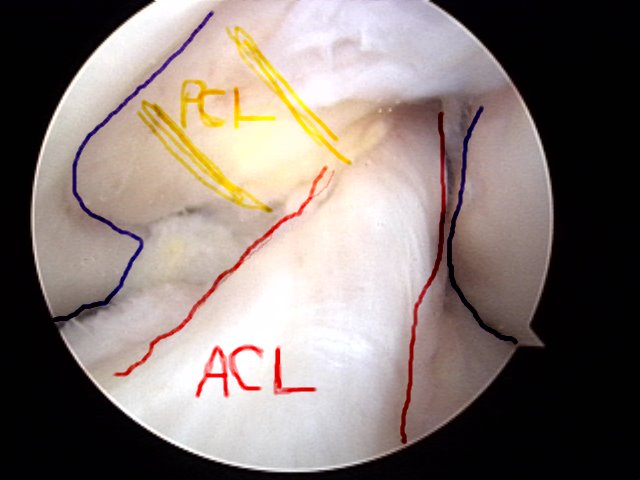 [acl1.bmp]