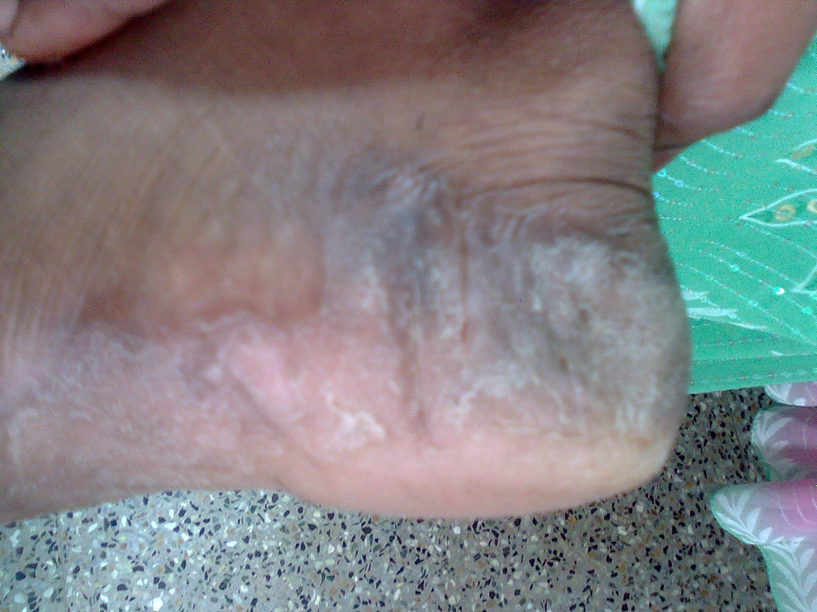 [Manjula+03-01-2010+(2).jpg]