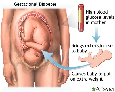 [diabetes+pregnancy.jpg]