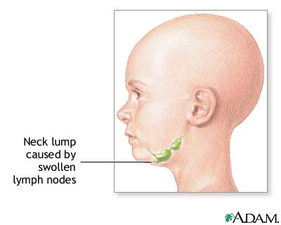 nodes in neck. These nodes are small and