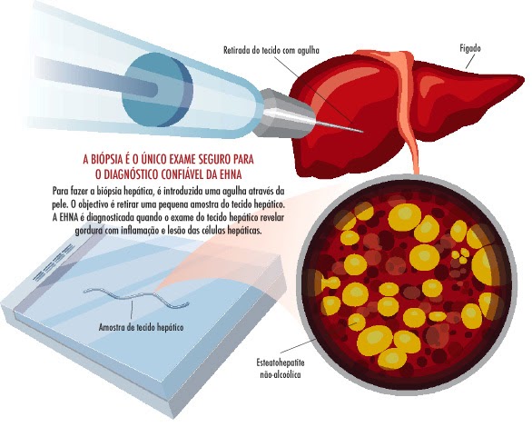 Exames funcao hepatica