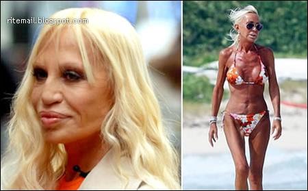 lady gaga 2011 face implants lady gaga horns face. lady gaga 2011 face implants