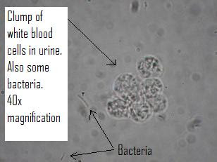 urine blood erudition aht cell grammer spelling atrocious excuse its