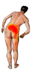 tratamento sem cirurgia hérnia de disco osteopatia quiropraxia mckenzie lombar