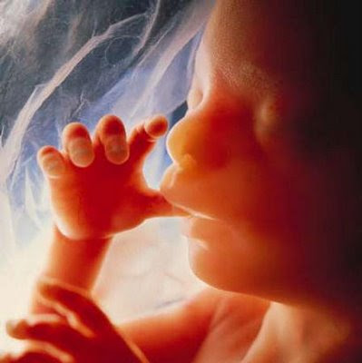 abortion 8 weeks. abortion 8 weeks. theblogprof: