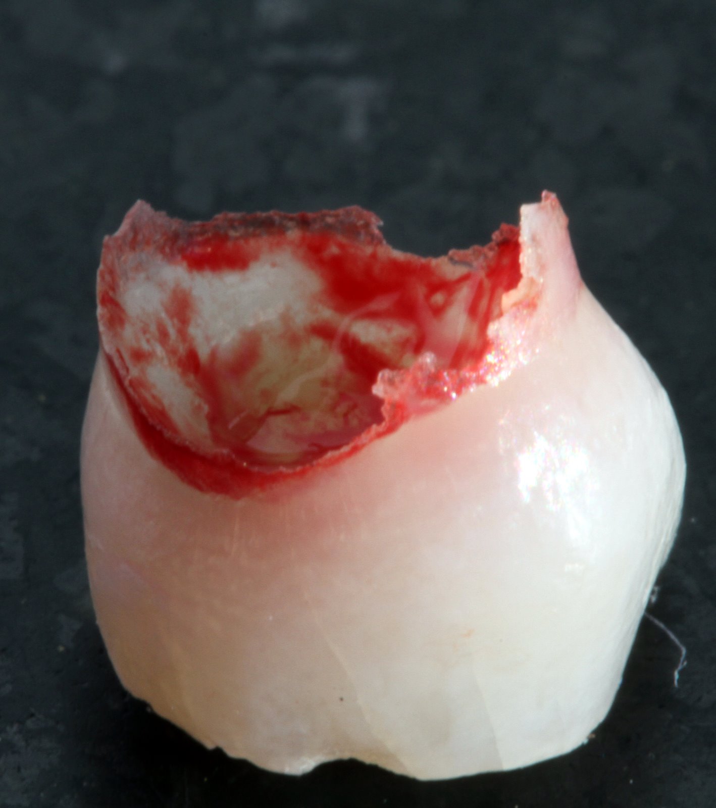 [2009-11-09+080915+031.JPG]