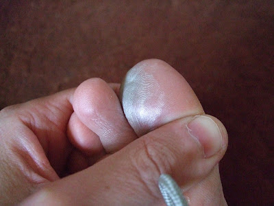 Super cooling your big toe