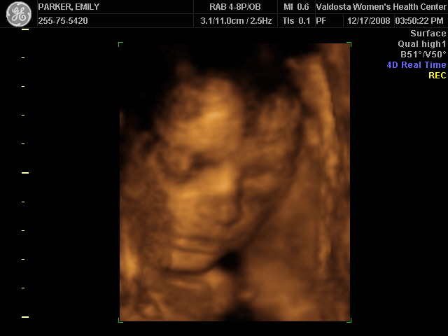 [BABY_32.JPG]
