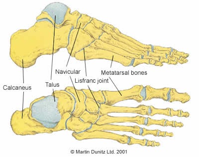 Findlay Foot Facts: Metatarsal Fracture in Depth