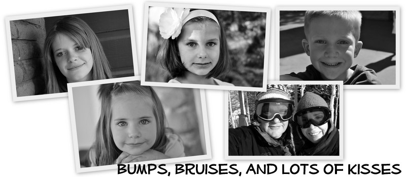 bumps, bruises, and lots of kisses...