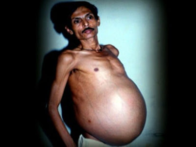 10 Keanehan manusia di Asia yang mengejutkan dunia Pregnant+man