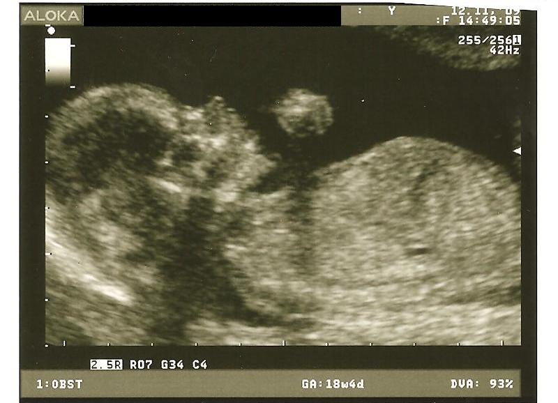 [Baby+Girl+(5b).JPG]