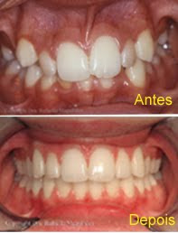 ORTODONTIA. POR QUÊ?