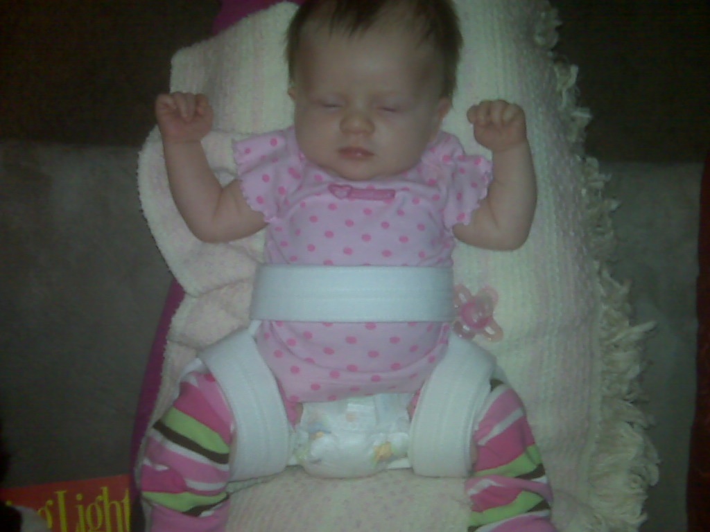Suggestions for baby in hip brace BabyCenter